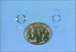 A very small incision will be made <br>and a tiny ultrasonic probe will be used to break up the cataract into microscopic particles using high-energy sound waves. This is called phacoemulsification.


The cataract particles will be gently suctioned away. Then, a folded intra-ocular lens (IOL) will be inserted through the micro-incision, then unfolded and locked into permanent position. The small incision is “self-sealing” and usually requires no stitches. It remains tightly closed by the natural outward pressure within the eye. This type of incision heals fast and provides a much more comfortable recuperation.

Here you can create the content that will be used within the module.